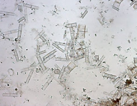 Advances in laboratory analyses of the Lake Yoa long core